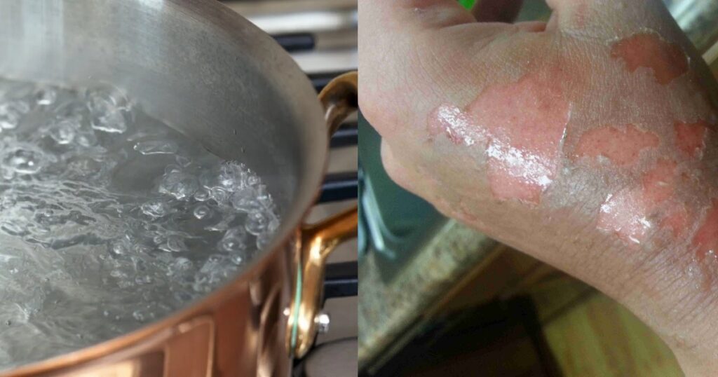 17-year-old-bauchi-housewife-pours-hot-water-on-teenager-for-allegedly-dating-her-husband