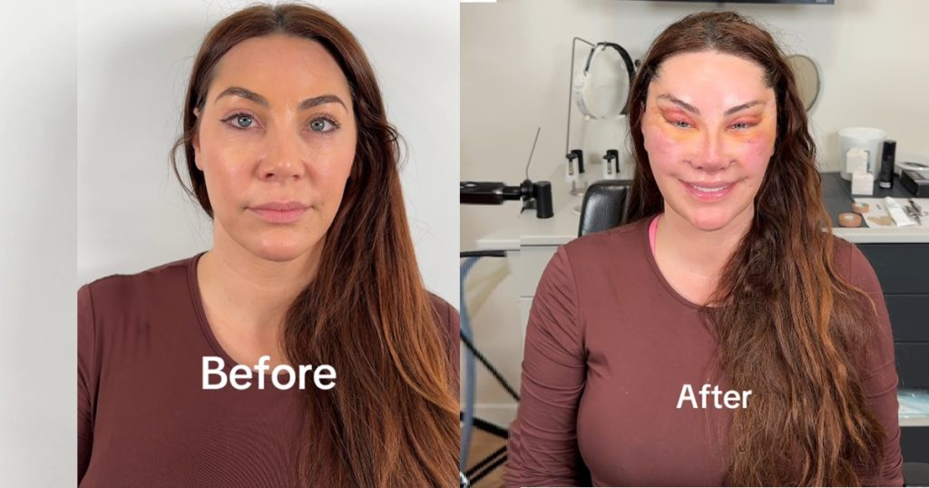 “we-watch-we-don’t-judge”-–-online-buzz-as-lady-shares-before-and-after-plastic-surgery-(images)