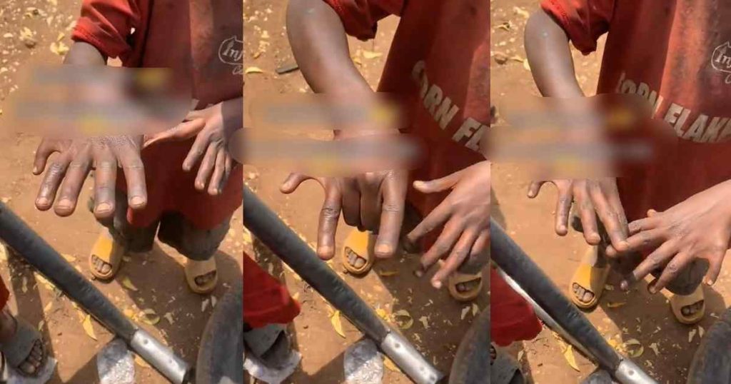“which-one-is-the-middle-finger-?”-–-man-astonished-to-discover-boy-with-six-fingers-(watch)