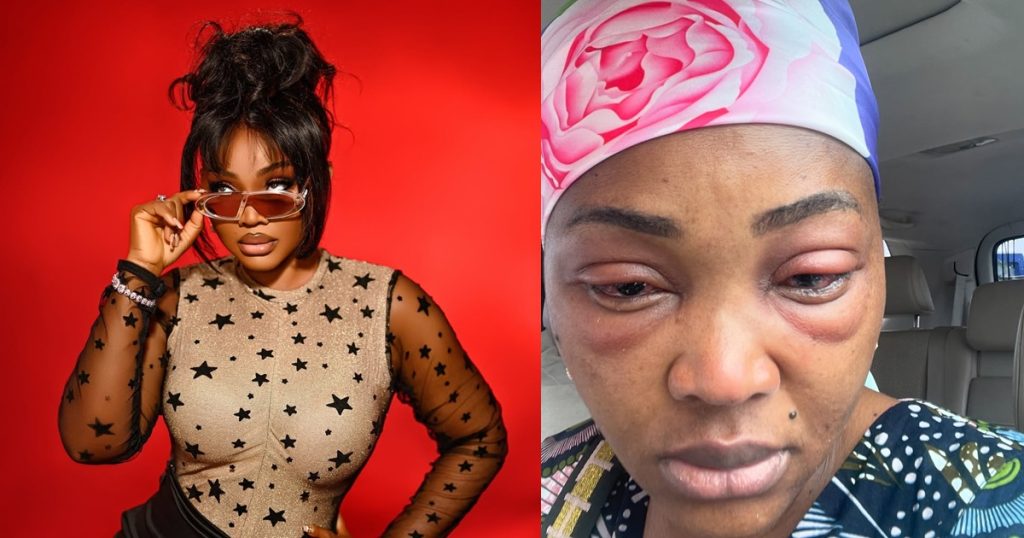 actress-mercy-aigbe-recounts-how-she-battlɘd-eye-infect!on-while-filming-her-new-movie-(images)