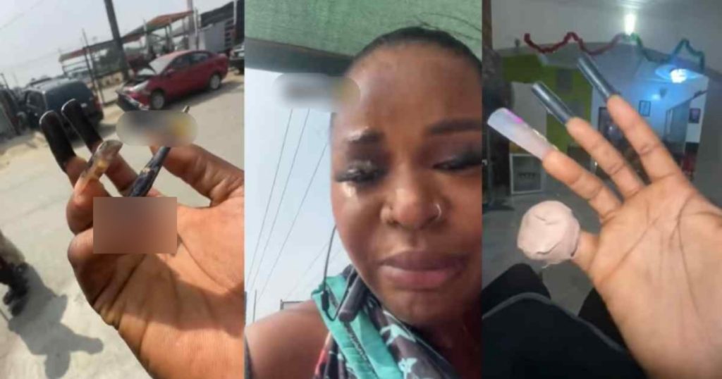 “you-will-go-for-bandage-to-bandage”-–-lady-suffers-injury-in-bid-to-compete-with-ijgb-ladies-(watch)