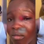 jss3-student-!njured-after-alleged-att@ck-by-senior-over-minor-inc!dent-(video)
