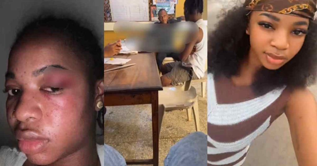 “them-don-blow-eye-witness-for-eyes”-–-lady-gets-a-black-eye-defending-a-friend-in-tox!c-relationship-(watch)