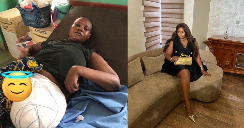 nigerian-lady-celebrates-one-year-of-surv1val-after-los!ng-her-leg-due-to-cancer-(photos)