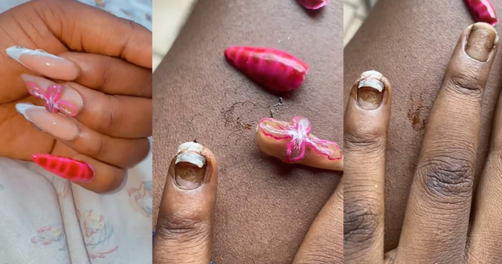 lady-f0rcefully-removes-month-old-artificial-nails,-claims-nail-tech-used-‘iron-gum’-(watch)